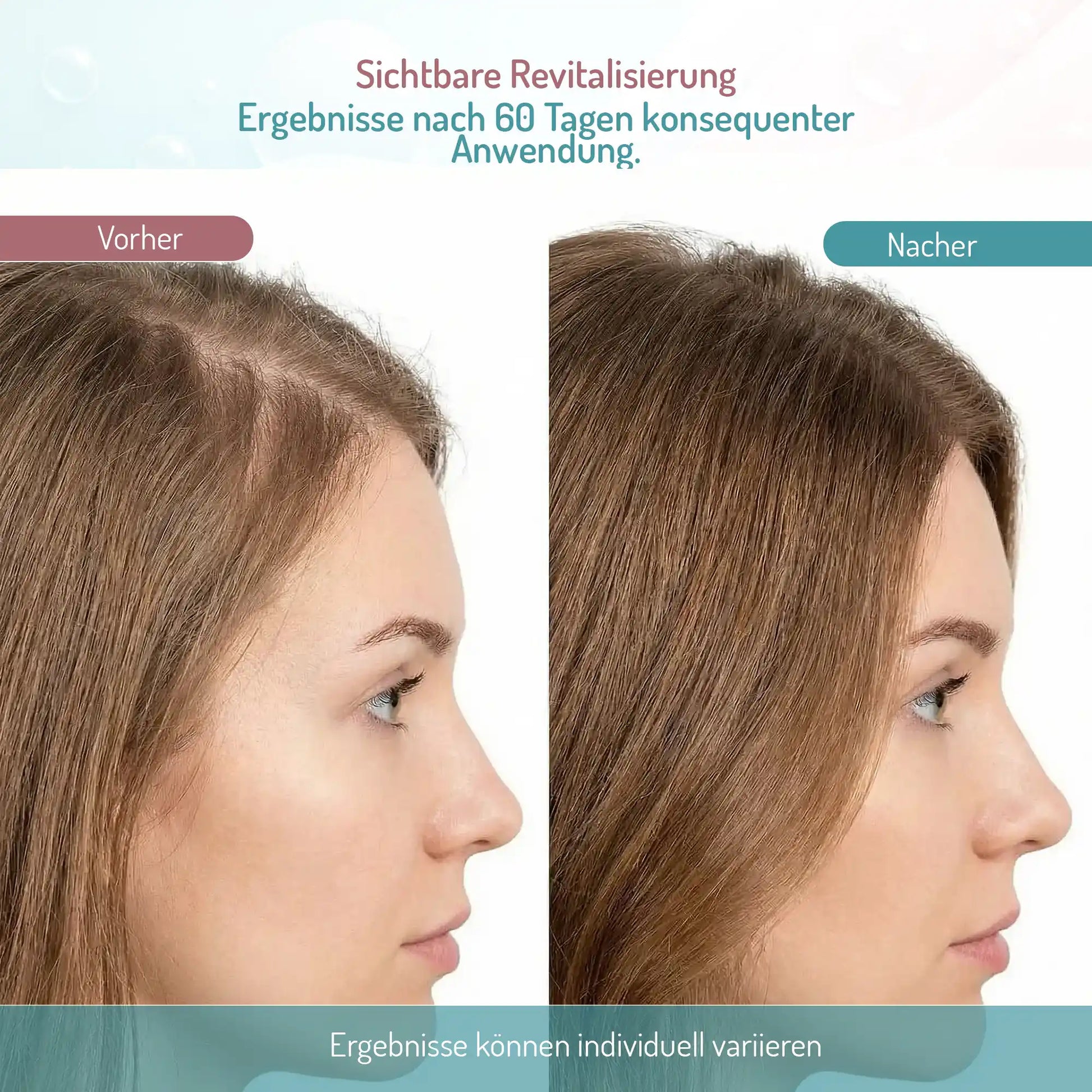 Raseel Hair Growth & Density Serum